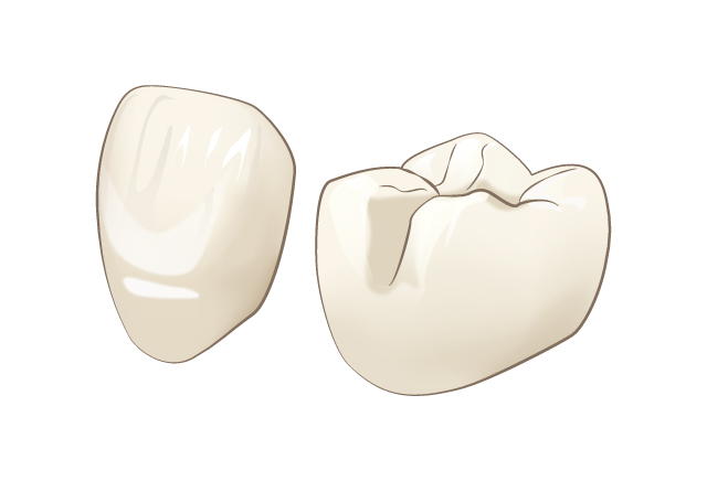 歯をキレイに美しくする施術
