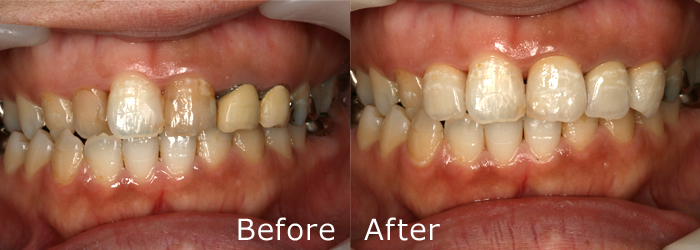 審美治療施術例