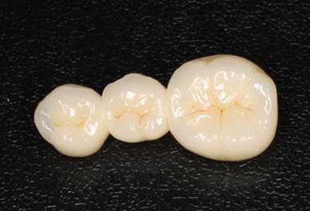 身体に安全なメタルフリー