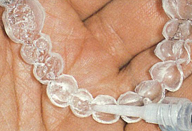 ホームホワイトニング