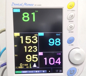 生体情報モニタ